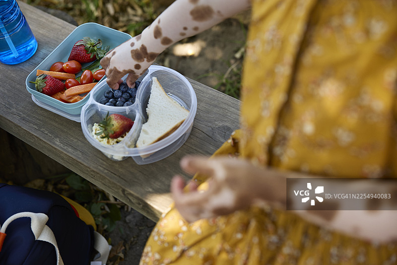 患有白癜风的女孩在午休时吃蓝莓图片素材