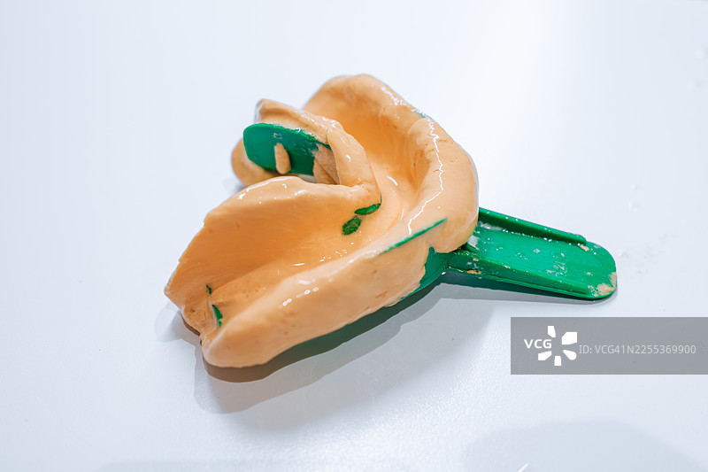 展示用于牙齿正畸的藻酸盐印模的牙科印模图片素材