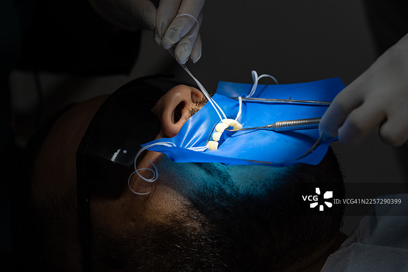 牙齿贴面放置程序图片素材