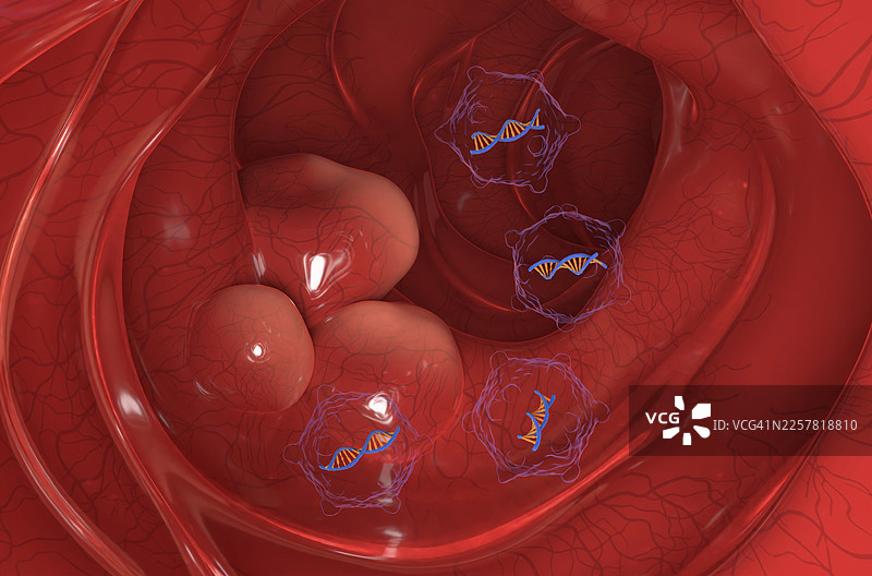 结直肠癌基因疗法，概念插画图片素材