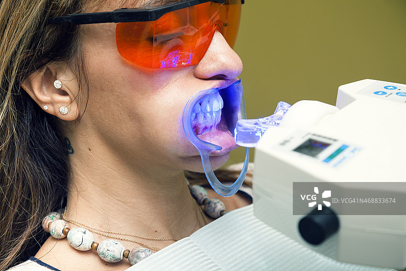 牙齿美白特写图片素材