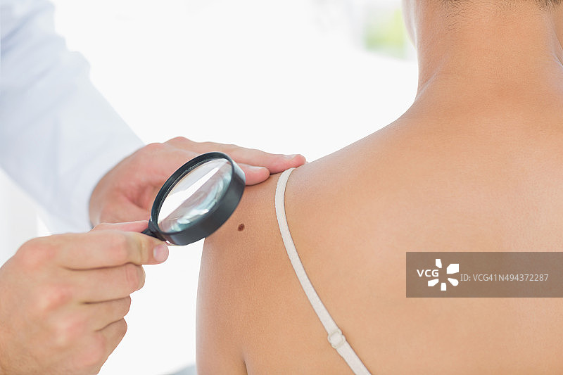 医生检查女性的黑色素瘤图片素材