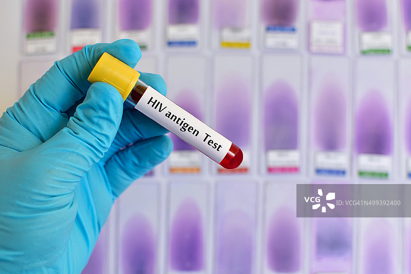 艾滋病毒抗原检测图片素材