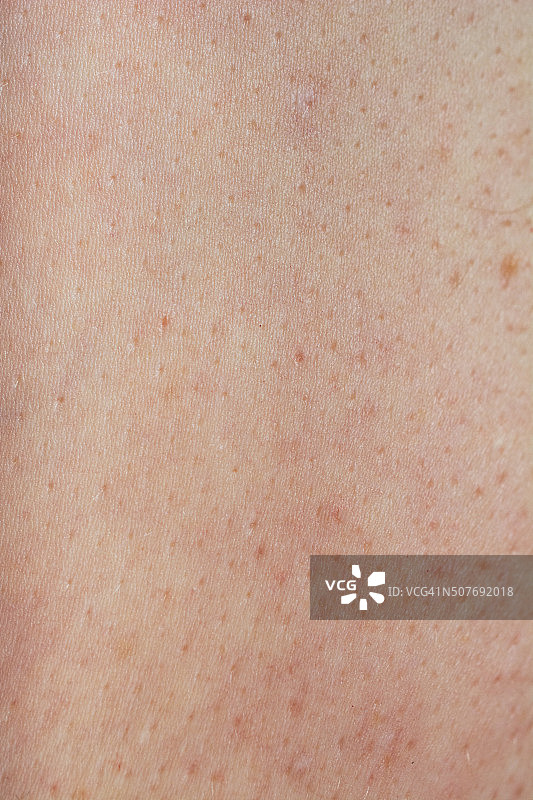 55岁以上的衰老肌肤图片素材