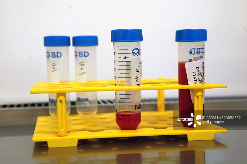 医院研究实验室中捐赠的干细胞图片素材