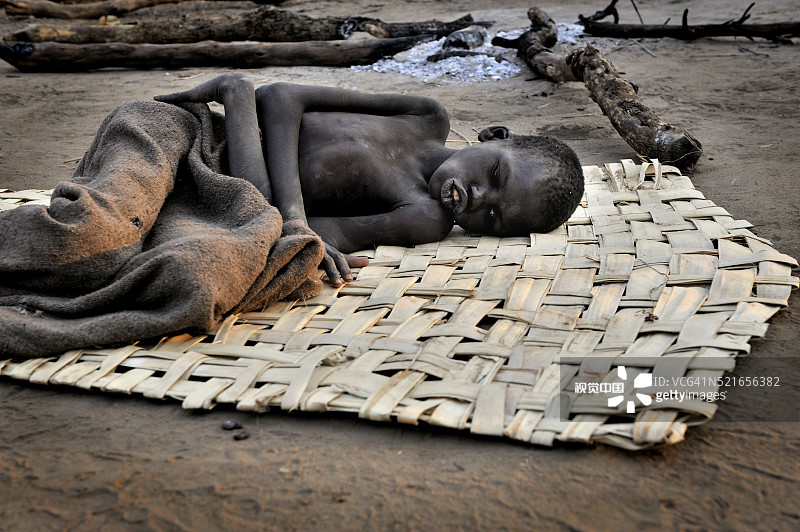 乌干达点头病图片素材