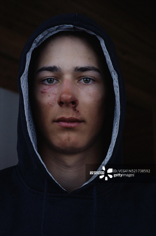 面部擦伤的滑雪者 Mads Jonsson图片素材