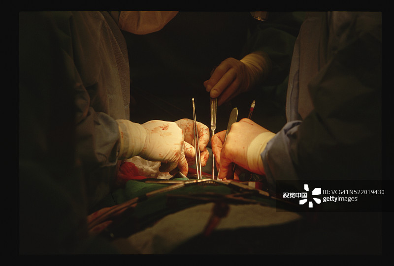 心脏搭桥手术特写图片素材