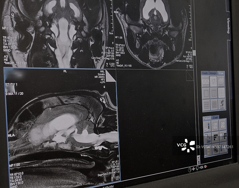 犬类头部MRI三个平面视图图片素材