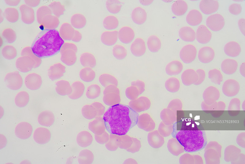 血涂片图片素材