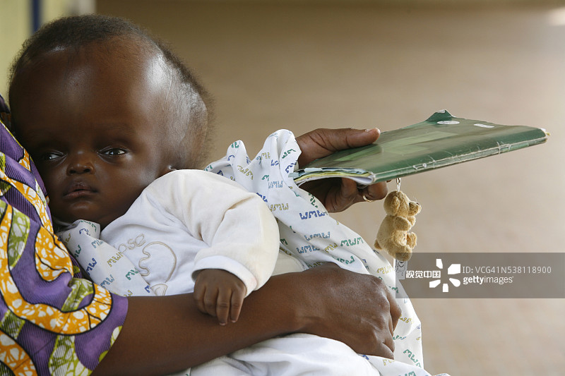 等候室里的脑积水婴儿图片素材