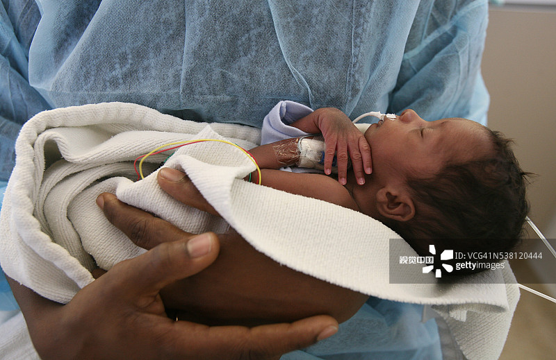 巴黎医院里的早产婴儿图片素材