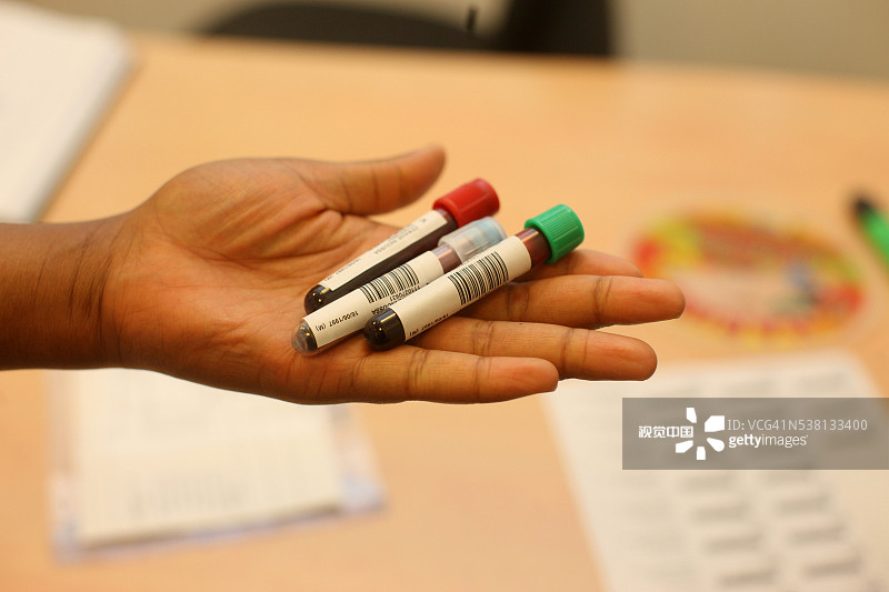 血液检测图片素材