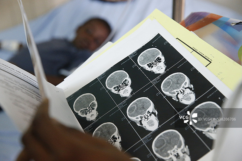 利伯维尔医院的患病儿童扫描图像图片素材