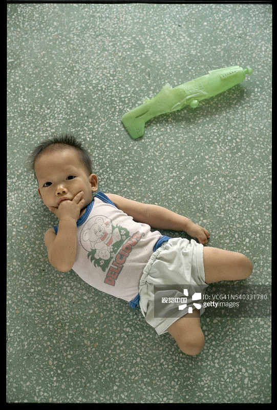 患有腿部畸形的婴儿肖像图片素材