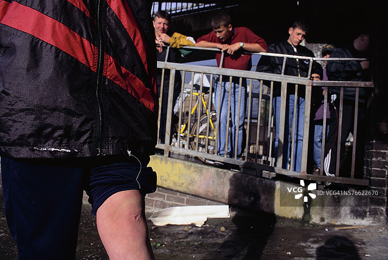 北爱尔兰青少年膝盖上的疤痕图片素材