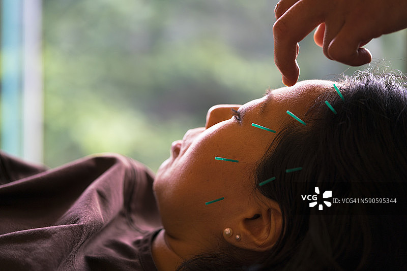 京都女性头部针灸治疗图片素材