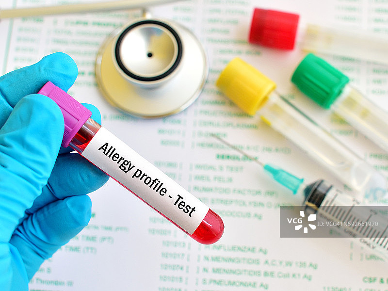 过敏原筛查测试图片素材