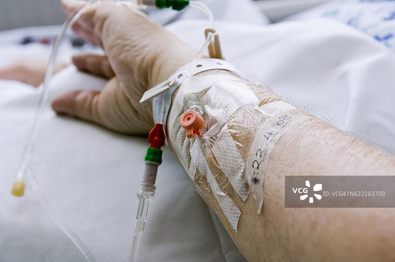 检查套管图片素材