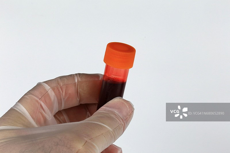 用于实验室检测的血样图片素材