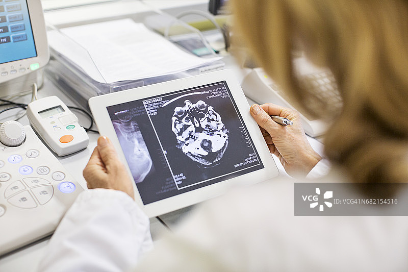 女医生在医院查看X光报告图片素材