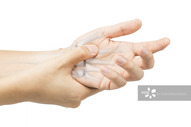手腕骨骼损伤图片素材