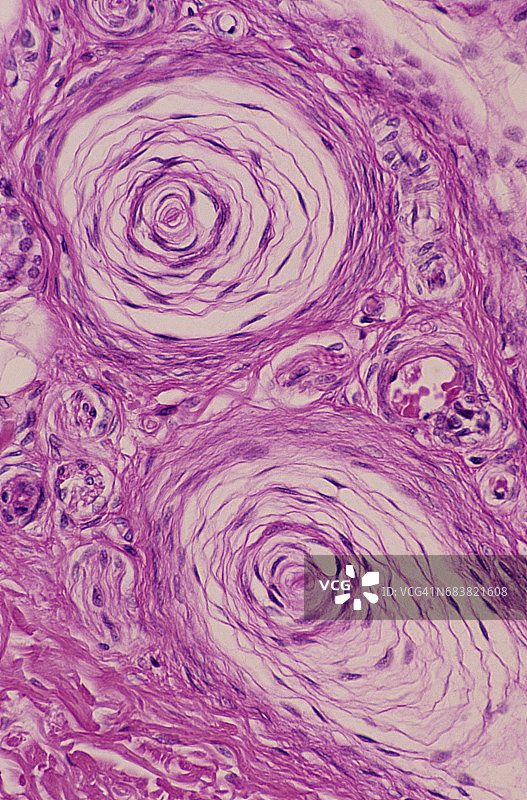 环层小体（又称Vater-Pacini小体）图片素材