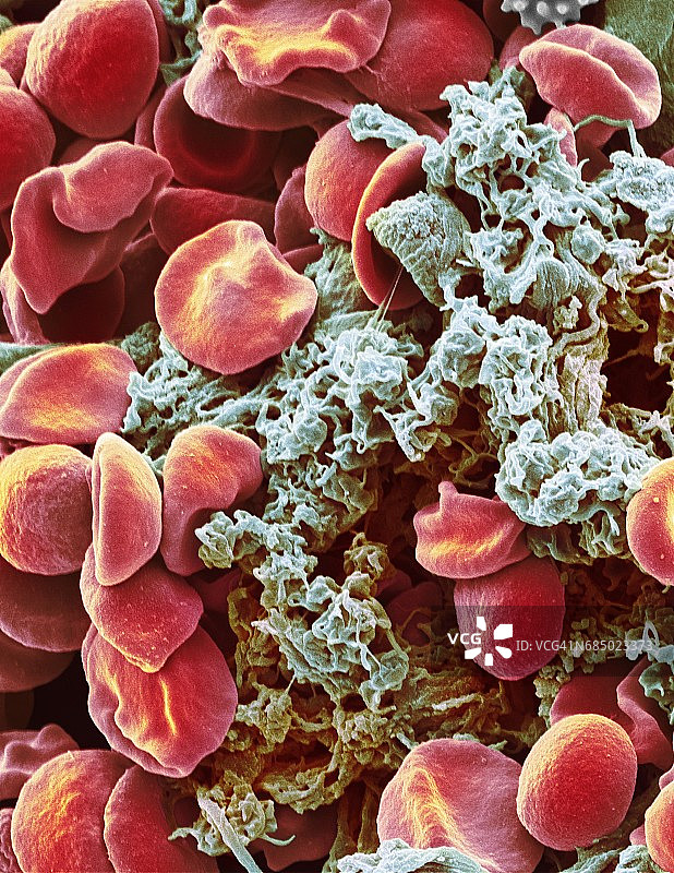 红细胞和血小板扫描电镜图图片素材