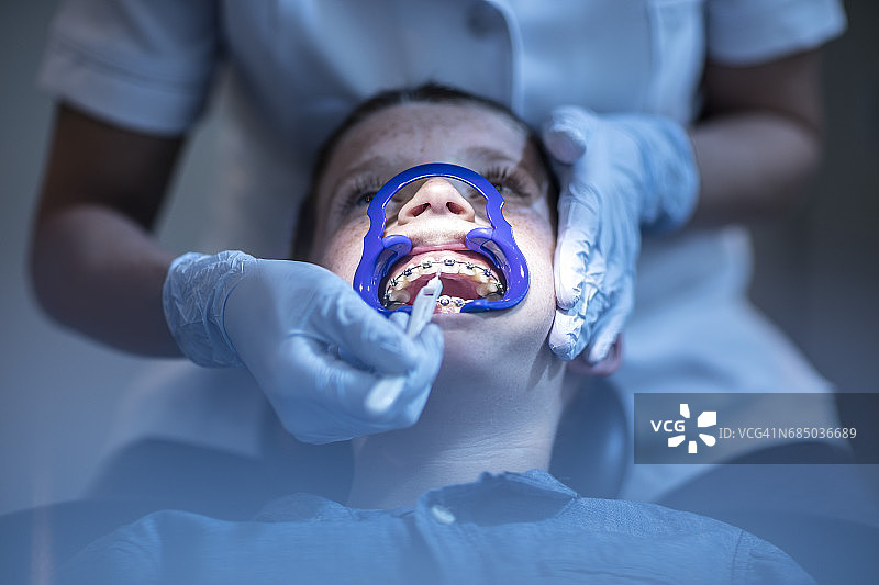 接受正畸治疗的牙科手术男孩图片素材