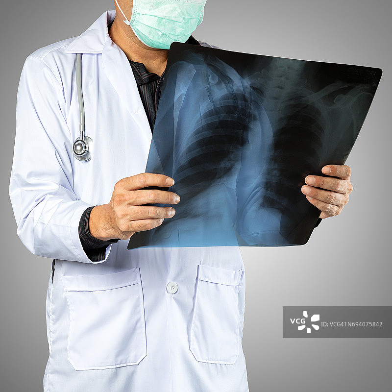 男医生手持X光片特写图片素材