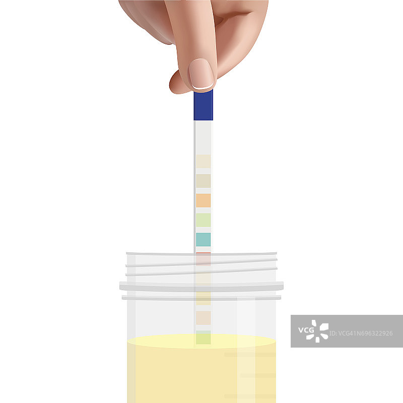 男人将尿液测试条放入尿液罐中图片素材