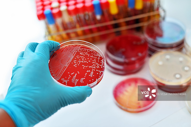 细菌培养图片素材
