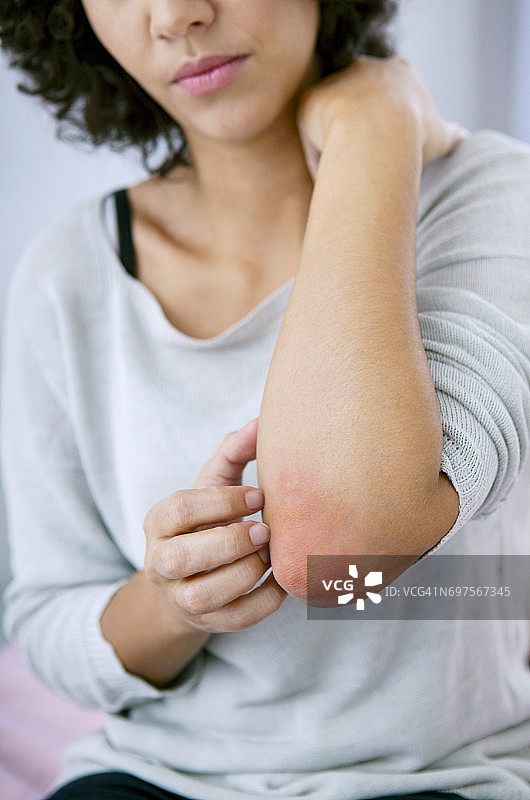 女性瘙痒图片素材