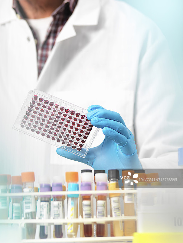 科学家在多孔板中准备血液样本，用于实验室临床测试图片素材