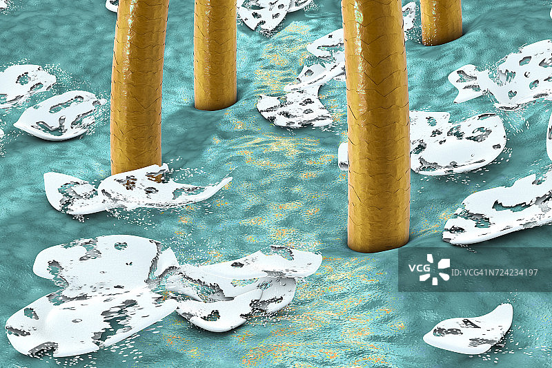 去除头皮屑，图示图片素材