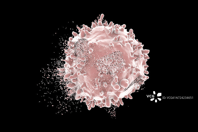 白血病血细胞破坏，图示图片素材