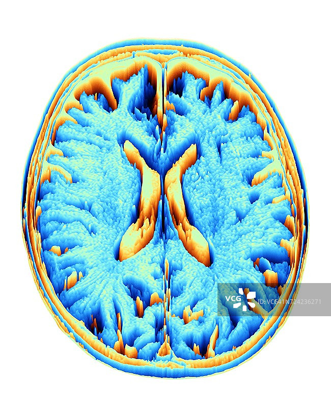 MRI脑部扫描，高度图图片素材