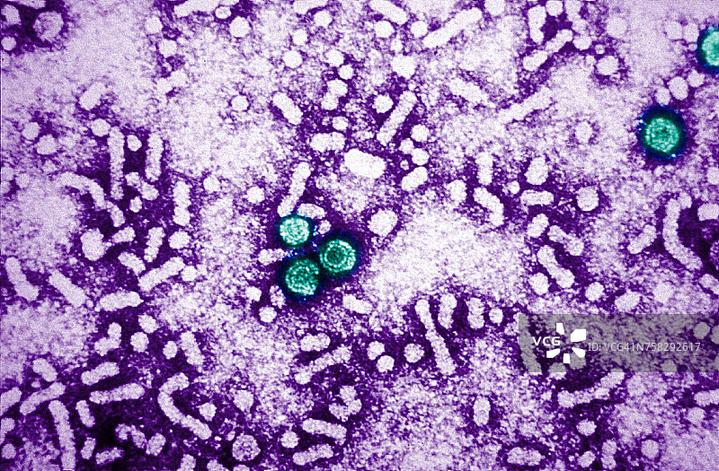 乙型肝炎病毒图片素材