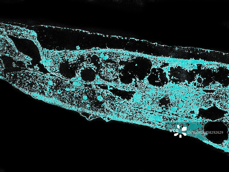 梅毒螺旋体图片素材