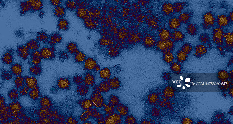 西尼罗河病毒图片素材