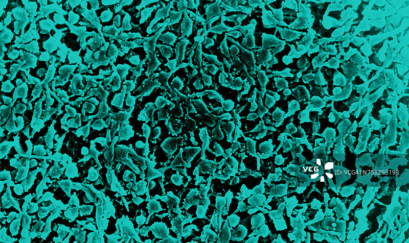肺炎支原体图片素材