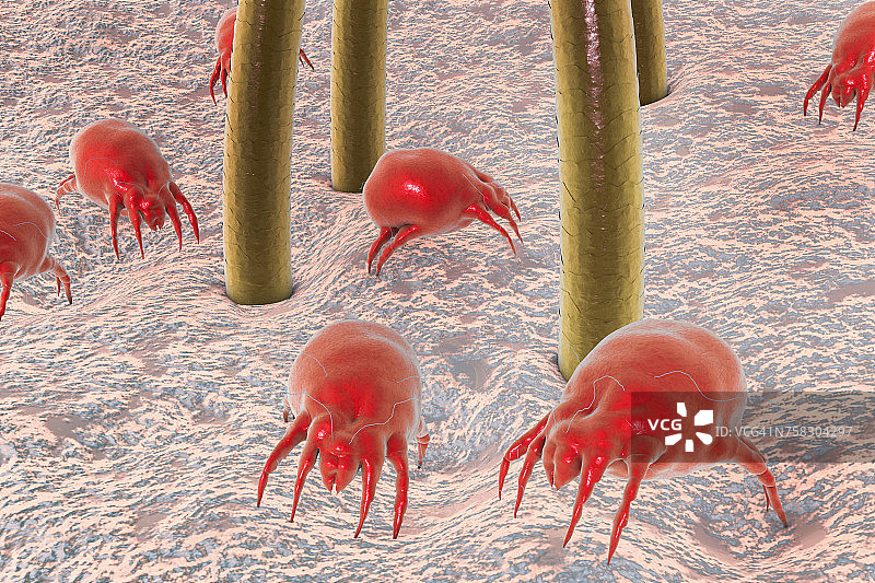 尘螨，图示图片素材