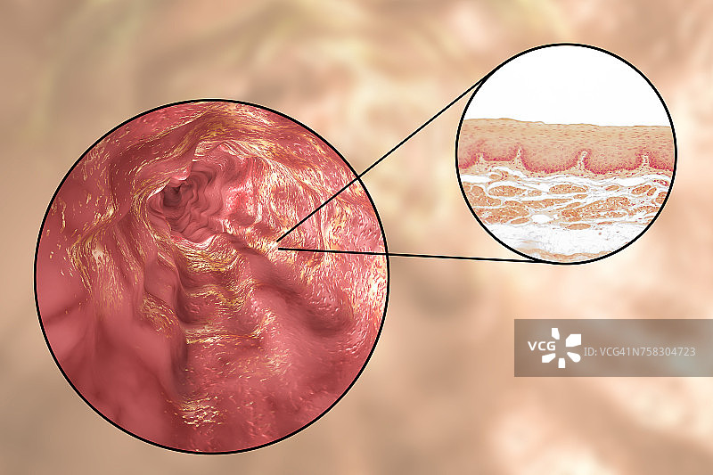 食管壁，光镜照片与插图图片素材