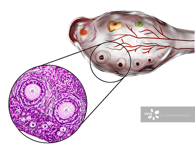 卵巢卵泡显微照片和插图图片素材