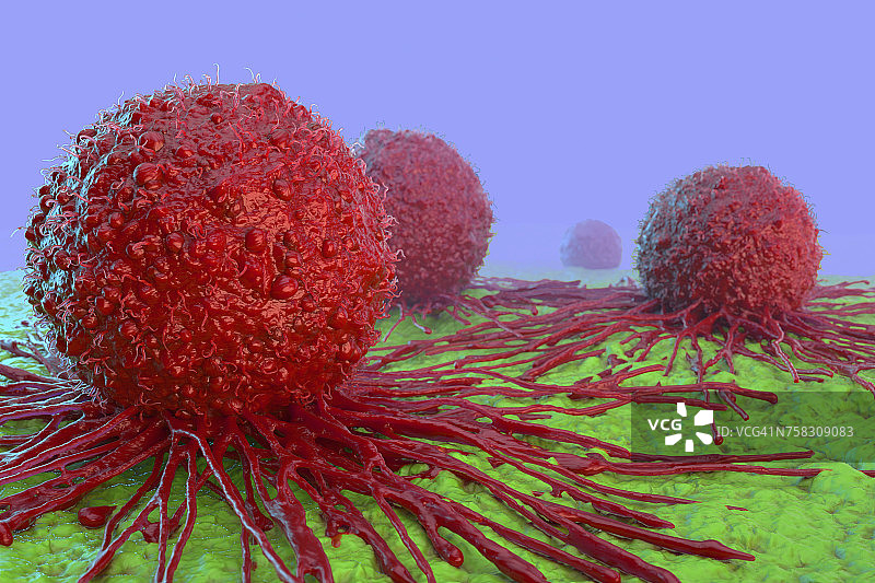 癌细胞,插图图片素材