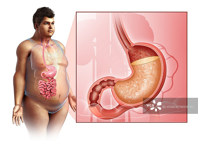 胃酸的男人插画图片素材