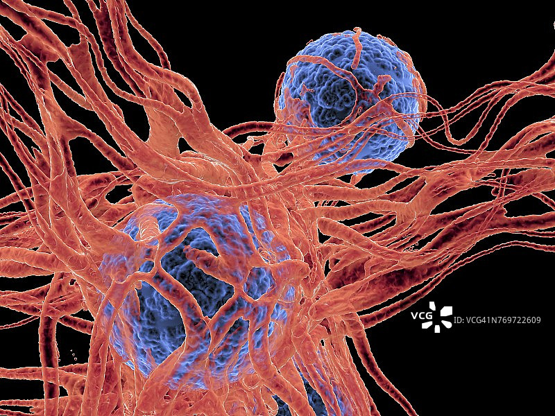 癌症细胞,说明图片素材