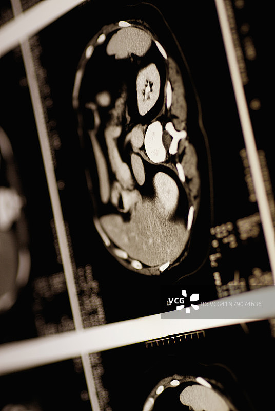 MRI扫描特写图片素材