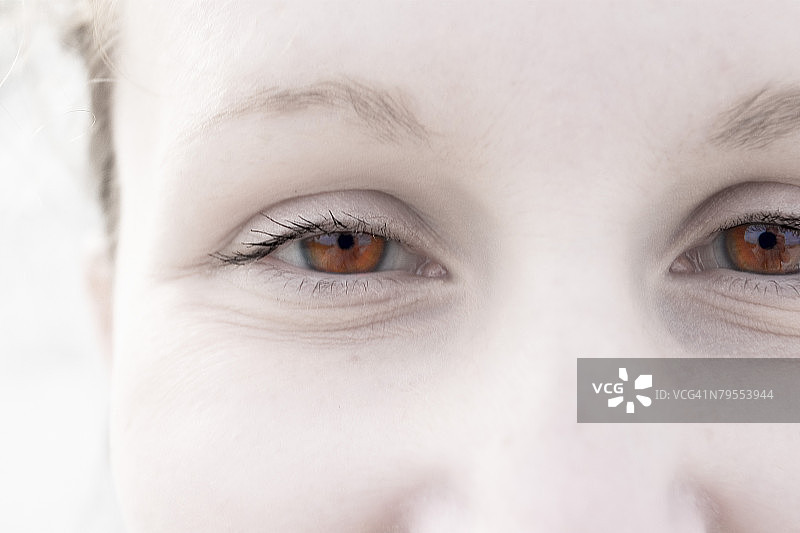 微笑的白化病女人的眼睛图片素材