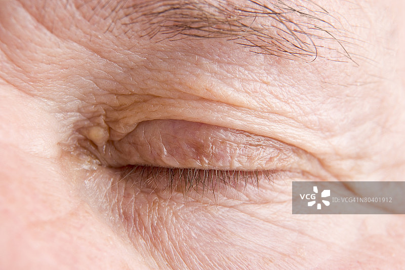 闭着的眼睛图片素材